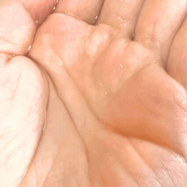 Kracie Hadabisei Acne Care Lotion 200ml